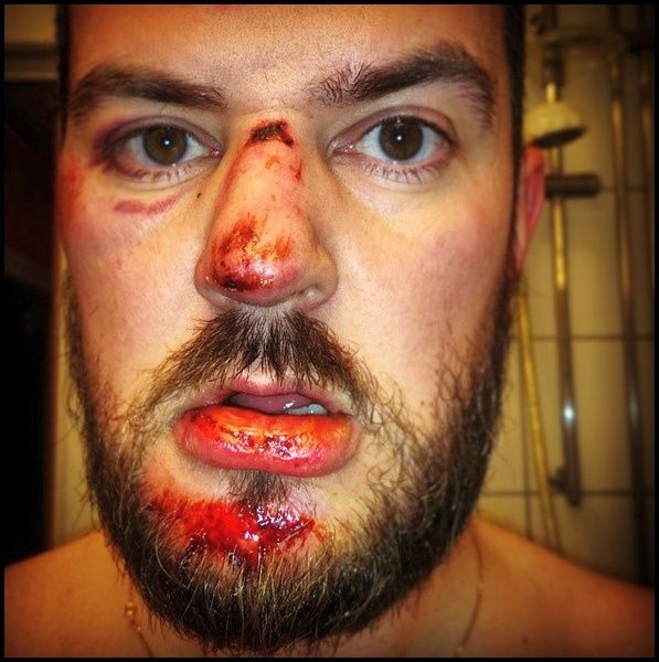 broms.jpg