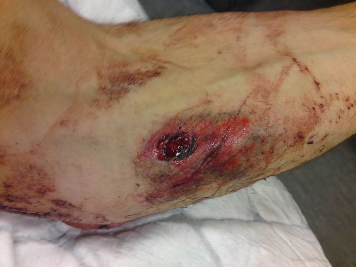 Deepcut_HBB.JPG ht=544