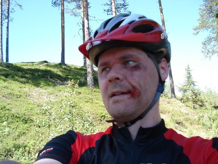Faceplantrrbcksnsrdaslingan.jpg ht=544