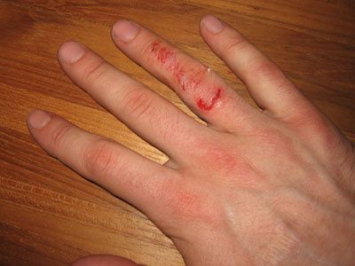 finger.jpg ht=300