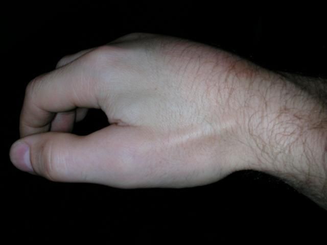 hand.JPG