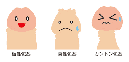 houkei.png ht=208