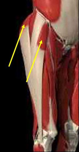 iliotibial.jpg ht=490