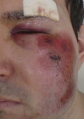 MTB_is_a_contact_sport.jpg ht=496