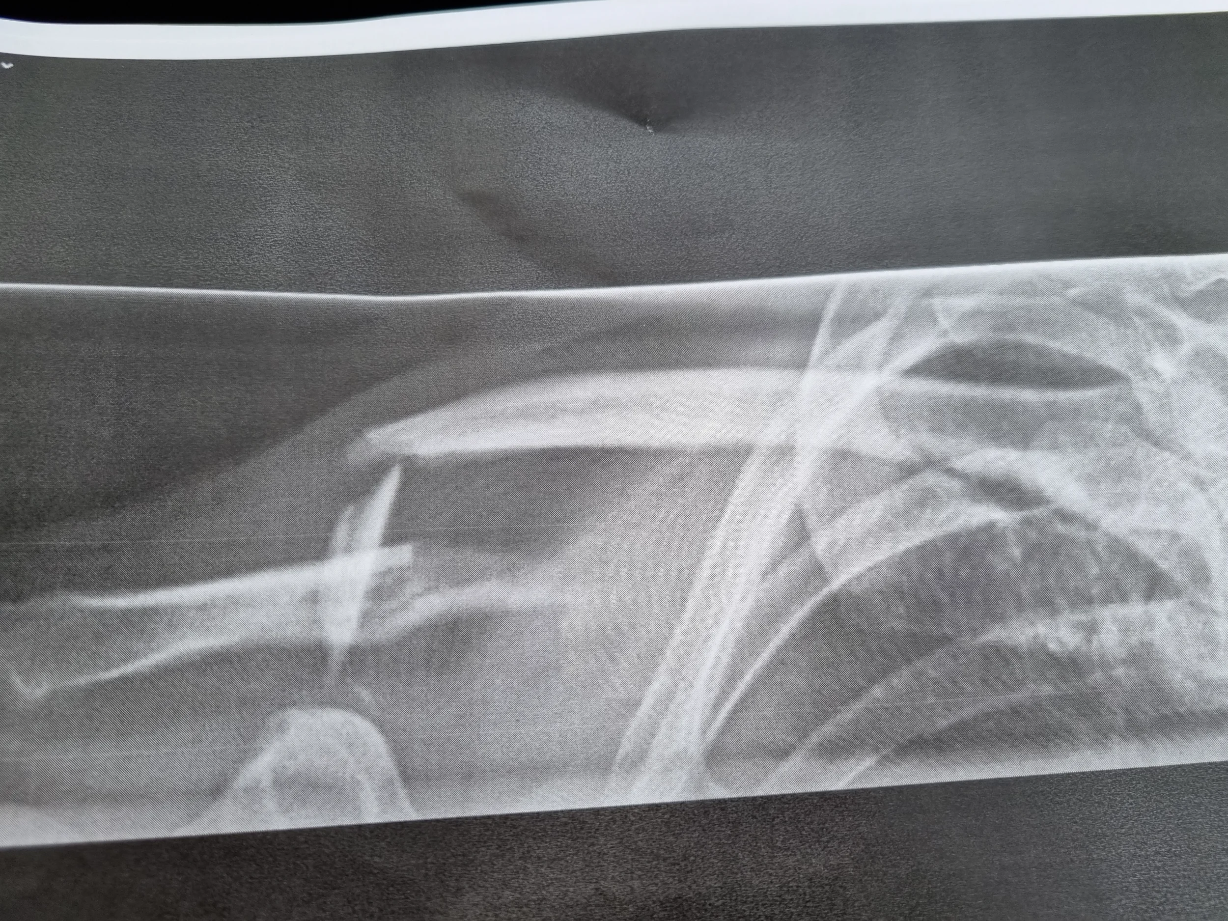 Nyckelben höger trasigt.webp