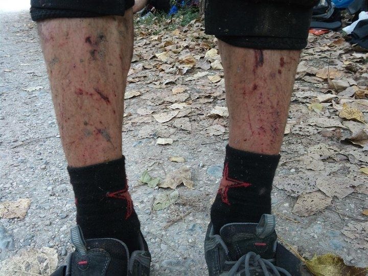 Ola_Carmonius_legs.jpg ht=540
