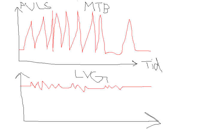 puls.GIF ht=453