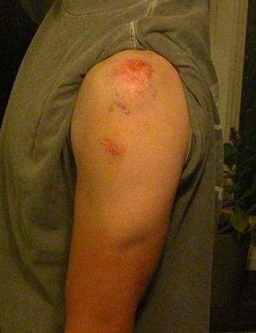 tatuering.JPG ht=470