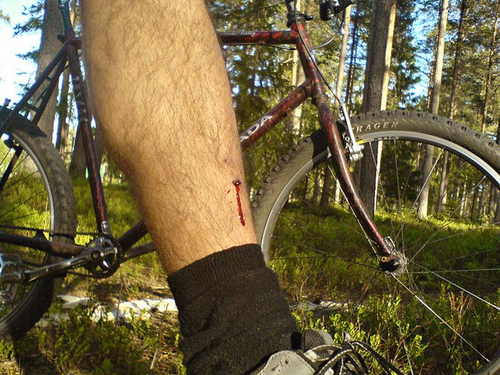 trampedal.jpg ht=544