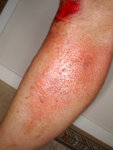Körde omkull 13 juli 2009 004.JPG