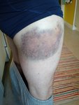 IMG_20160511_201038463.jpg