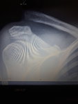 20161128_125140.jpg