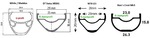 TLR.png