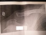 IMG_20180611_093406.jpg