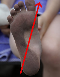 pronation-fotisattning.jpg.pagespeed.ce.itVUV3wNLx.jpg