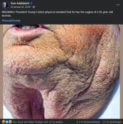 Trump has the vagina of a 95 year-old woman @Tom Adelsbach 2026-01-23.webp
