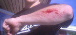 armbageblod.jpg