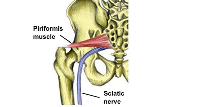 piriformis800-800x426.jpg